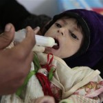 سات  ملین یمنی بھوک سے مرنے کے قریب پہنچ گئے