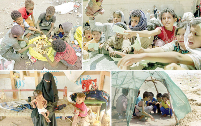 خانہ جنگی سے تباہ حال یمن میں بدترین قحط کے باعث 80 فیصد آبادی خوراک کو ترسنے لگی